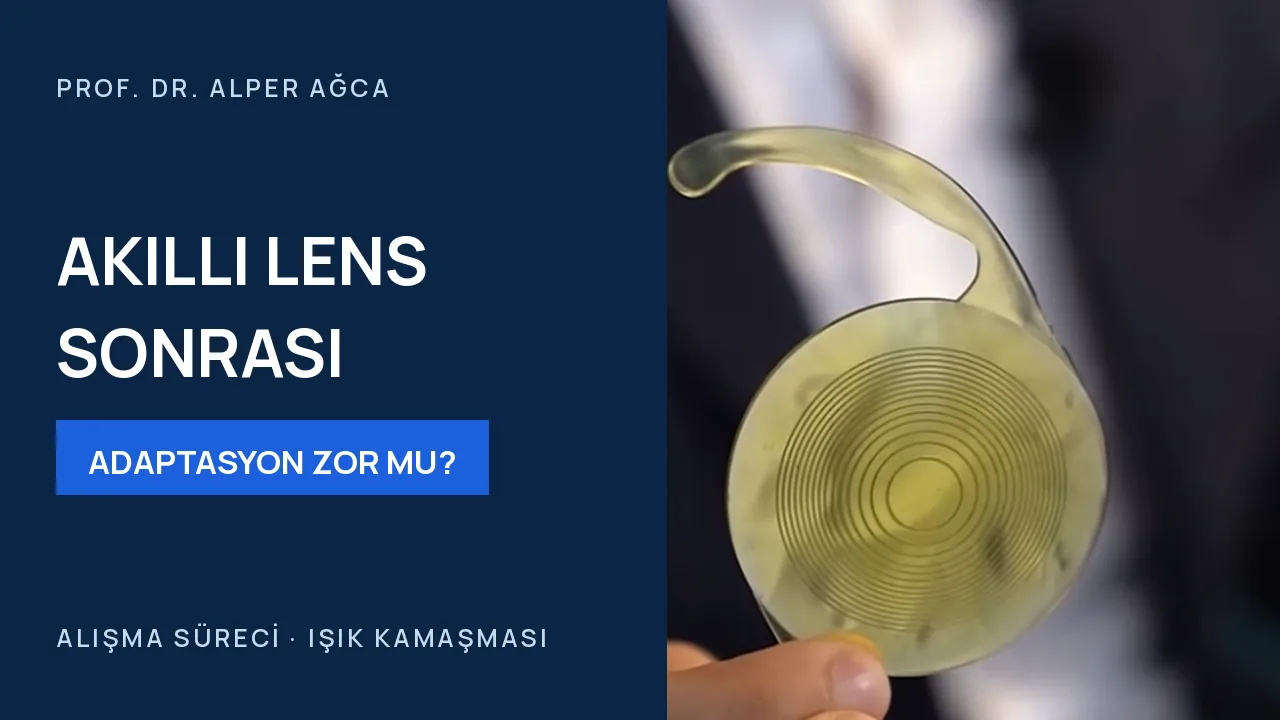 Akıllı mercek sonrası adaptasyon zor mudur? — video kapağı