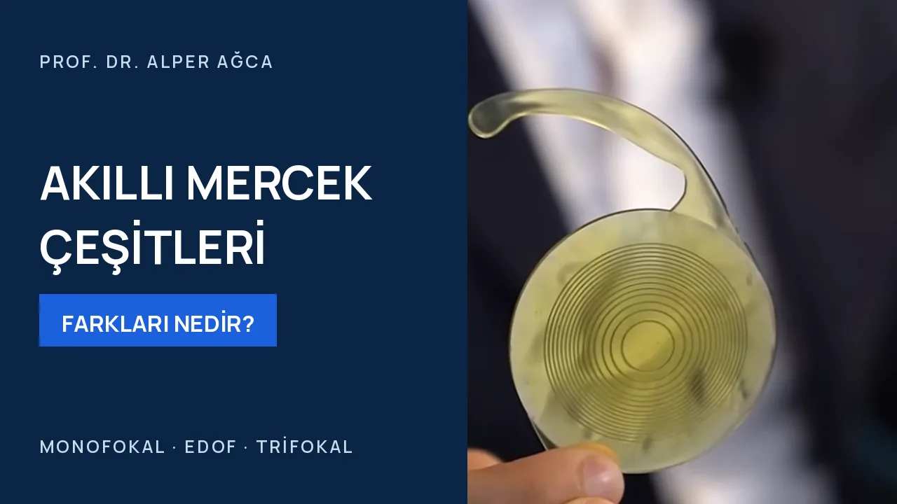 Akıllı mercek çeşitleri nelerdir? — video kapağı