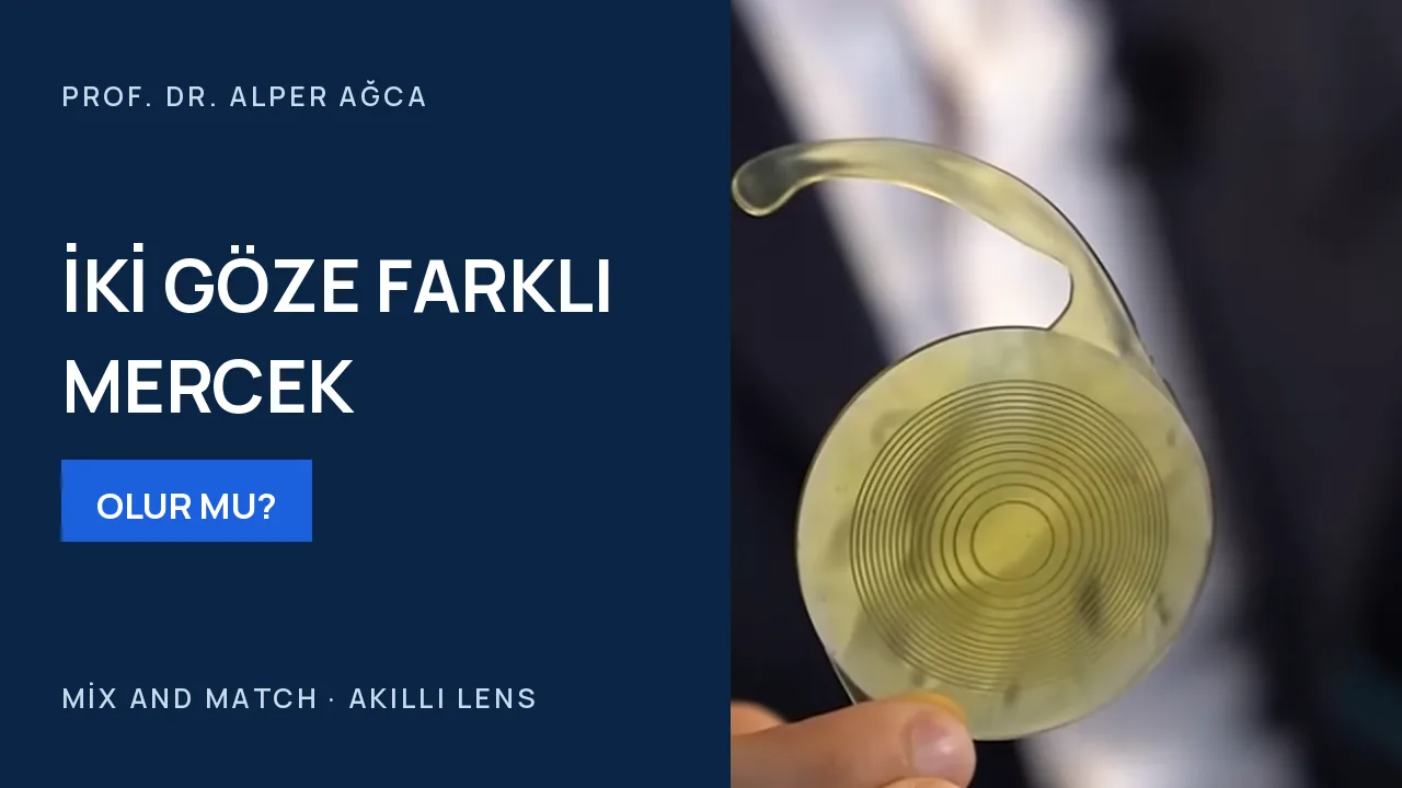 İki göze farklı tipte mercek takılır mı? — video kapağı