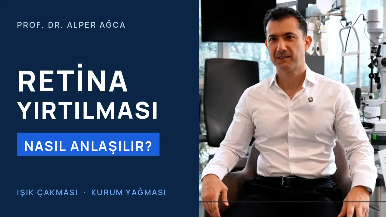 Retina yırtılması belirtileri: gözde ışık çakması ve kurum yağması — video kapağı