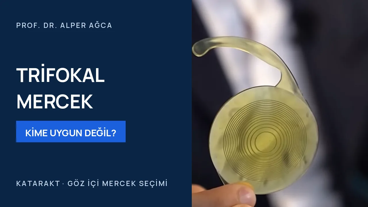 Her katarakt hastasına trifokal mercek takılabilir mi? — video kapağı